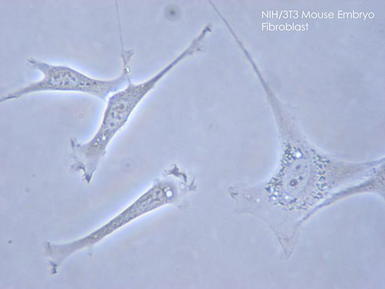 fibroblasts