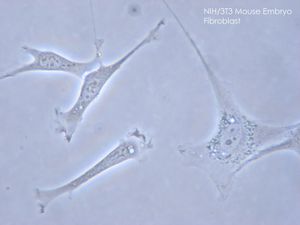 fibroblasts